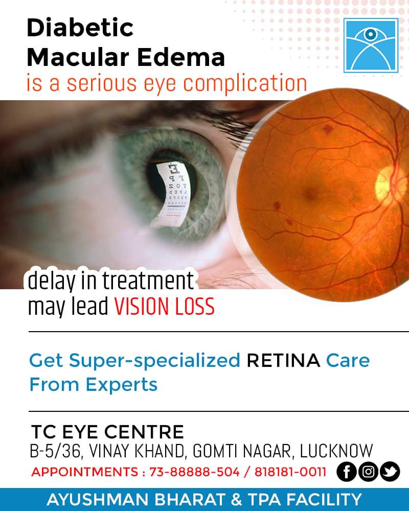 Diabetic Macular Edema can cause irreversible damage to vision if not treated on time. Get timely consultation and proper treatment. Call Helpline : 7388888504 / 8181810011
-
TC EYE CENTRE, LUCKNOW
#DiabeticMacularEdema #TCEyeCentre