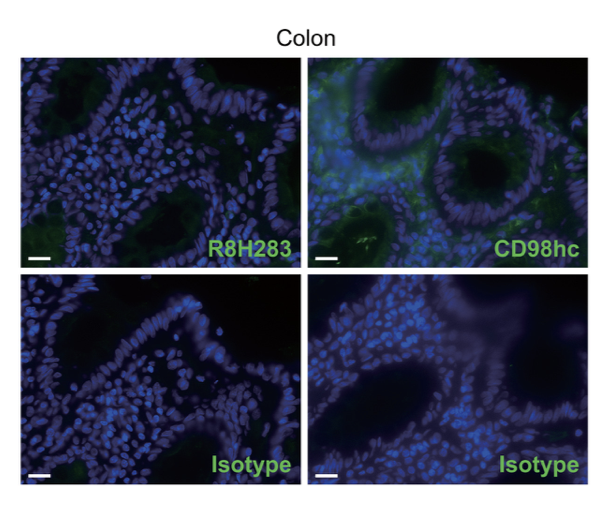 VIncelius's tweet photo. ScienceMagazine: Scientists have discovered that antibodies targeting the common amino acid transporter component CD98 heavy chain can selectively kill #MultipleMyelomas in mice while leaving healthy cells intact. @ScienceTM #Cancer … https://t.co/4p5U03ic0Q
