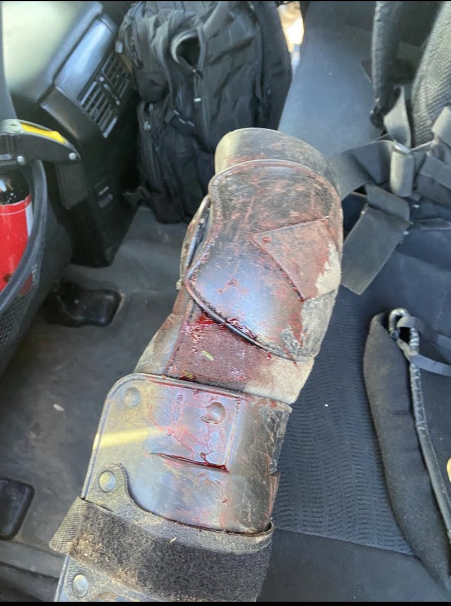 El padre de mi hijo es Guardia Civil destinado en comisión de servicios en Melilla. 

Me he despertado con un mensaje de:

 “Irene, nos iban a matar. Son miles con ganchos, piedras y nos tiraban cal. Hay compañeros en el hospital” 

Menos aplausos a nuestras FCSE y más soluciones