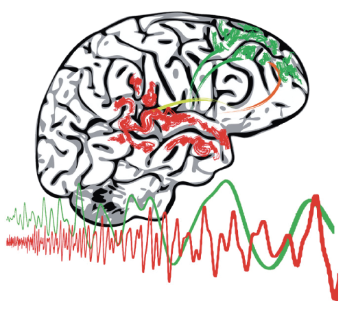 A <a href="/NSynapsy/">NCCR-Synapsy</a> trans-disciplinary team from <a href="/unige_en/">UNIGE_en</a>  has identified that a communication defect between areas of the brain – detectable from childhood to adulthood – is linked to #schizophrenia. A significant step forward for diagnostics and early interventions planning.