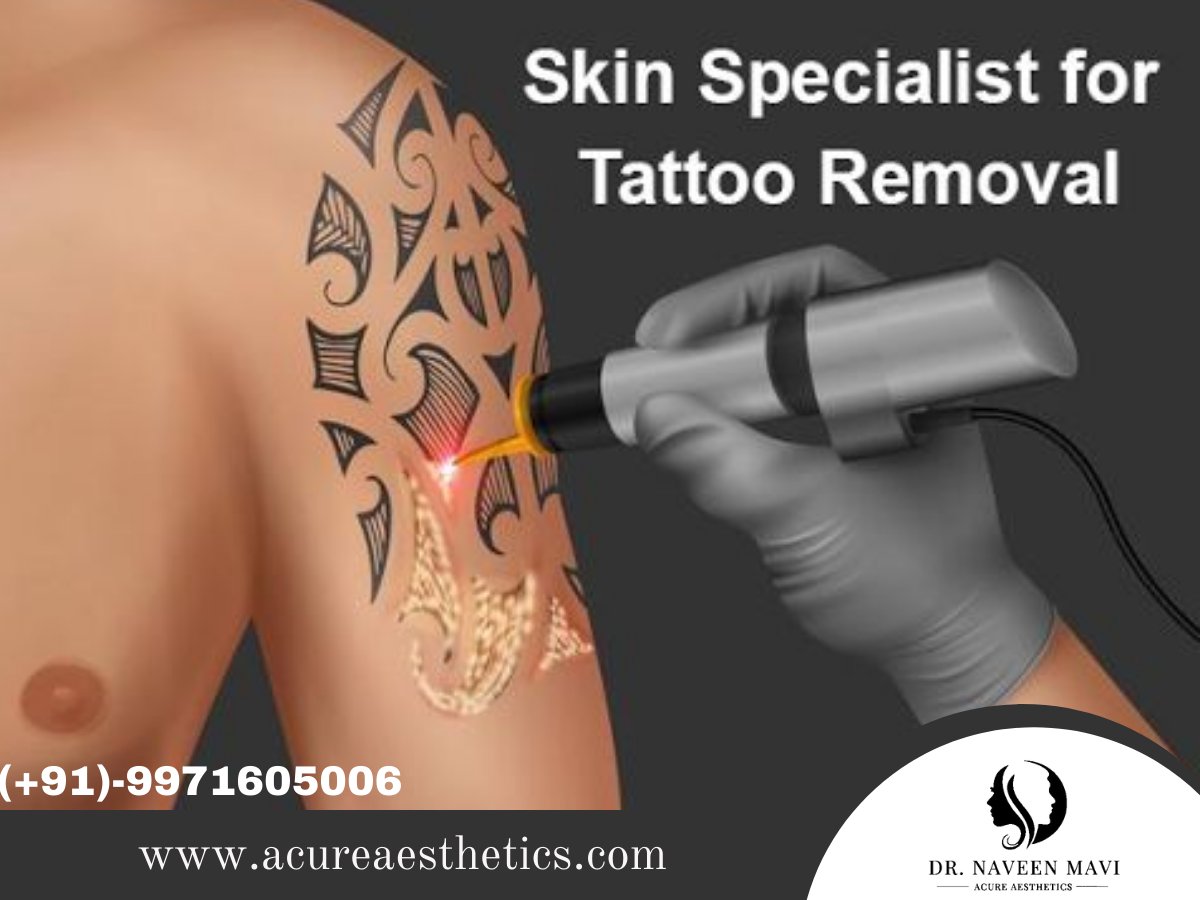 Sai Skin Aesthetics - Laser tattoo removal treatment with Sai Skin  Aesthetics Get safe, painless, effective treatment Contact the best  dermatologist Call us on to book an appointment : +91-8299633060  #saiskinaesthetics #dermatology #