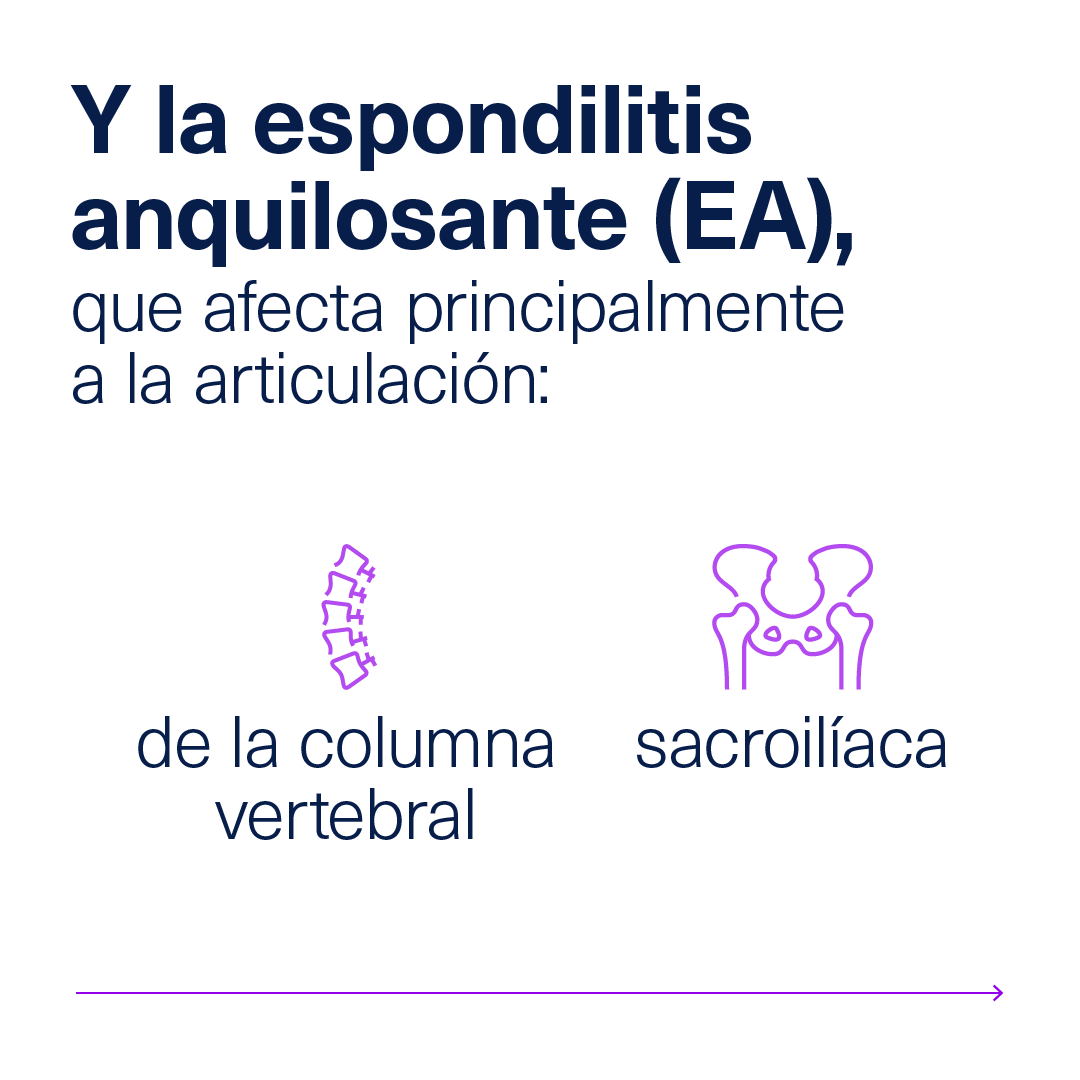 AbbVie_ES's tweet photo. Aunque por su nombre son menos conocidas, las espondiloartritis
afectan a más de medio millón de personas en España 🧐

¿Sabes qué son y cuáles son sus síntomas?

Para conocer más visita #AbbVieCare 🔎

➡️ https://t.co/2YNmvweZk0 https://t.co/eEjnlTr1uf