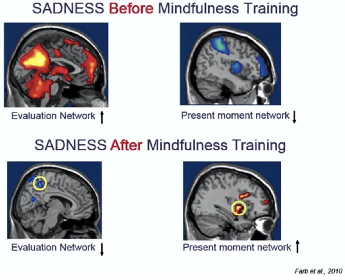 Cure #depression without meds?
Yes. Yes, you can. 
Most people don’t know this. 
But the fact is, you don’t necessarily need pills.
With the right lifestyle changes, your symptoms can decrease 
or even disappear altogether
bit.ly/3mbgWER