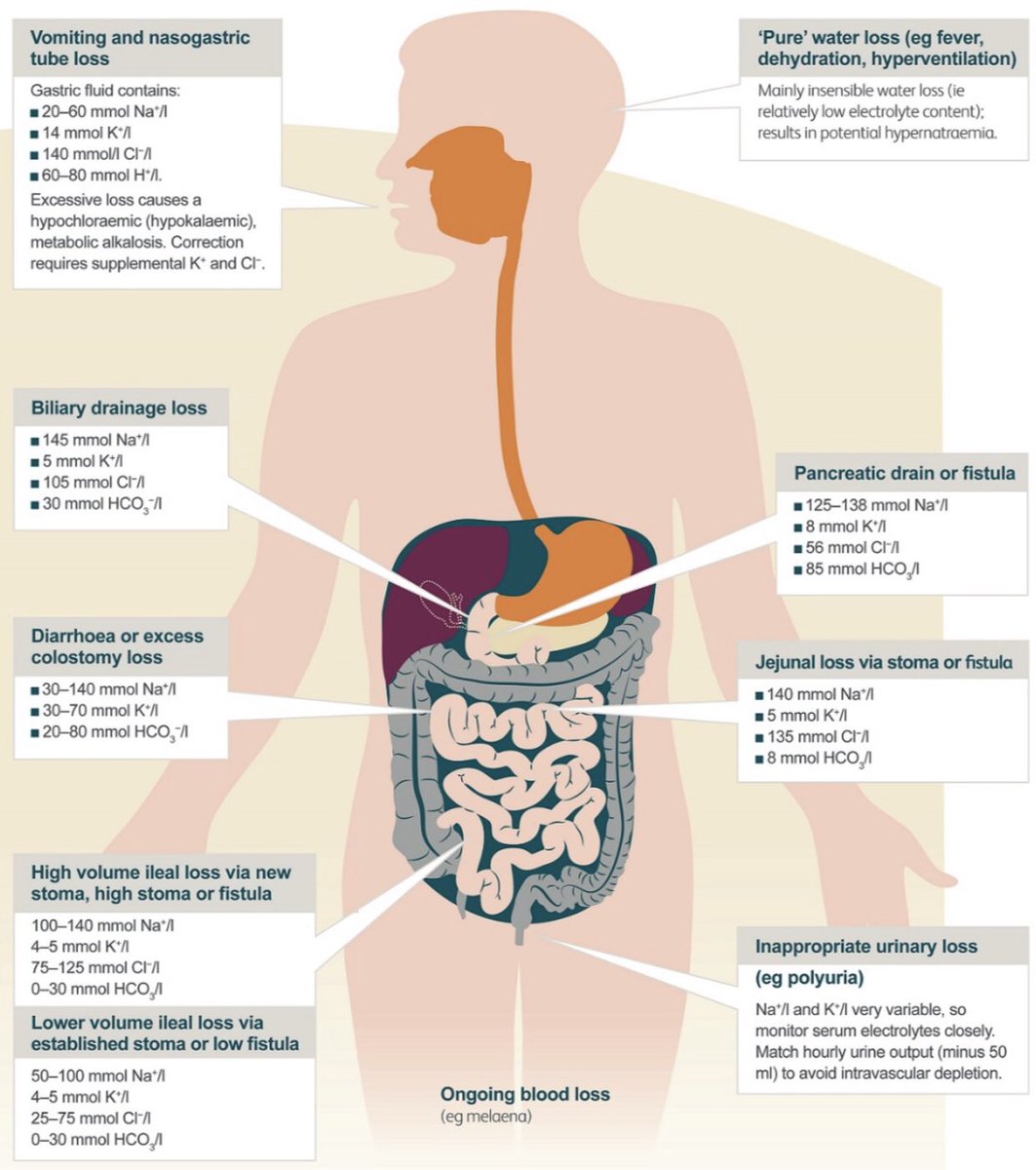 CMNO_MedInt's tweet photo. Guía de práctica clínica:
Terapia con líquidos intravenosos en adultos hospitalizados.

Revista: @NICEComms 
Acceso: https://t.co/WsASTDPLJn https://t.co/KCpt0cVZfw