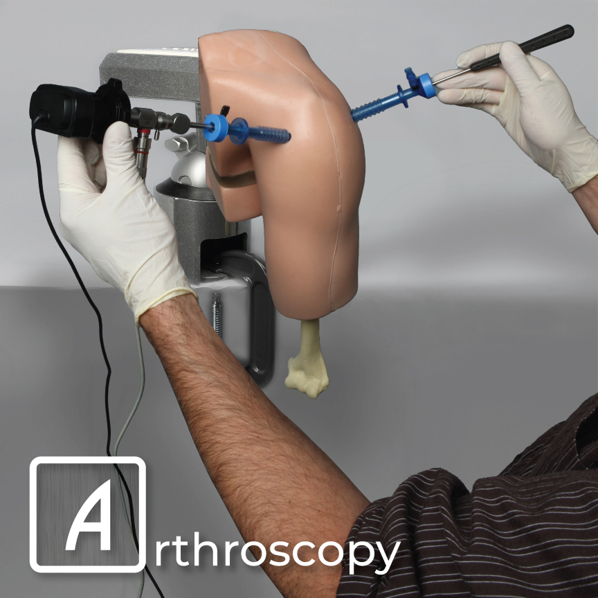 SawbonesNow's tweet photo. A is for Arthroplasty and Arthroscopy. Both are surgical procedures performed to restore mobility. However, #Arthroplasty is a #jointreplacement and #Arthroscopy is the treatment of the damaged joint using an #arthroscope.
Regardless...There's a Sawbones for that! #orthoTwitter https://t.co/euqaTFTzhT