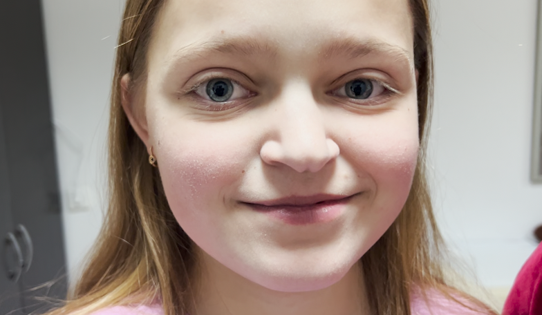 Eres padre, tienes hijos, viajas a #Kiev, entras en un hospital, ves una niña de 15 años, tiene una malformación congénita en el corazón, lleva una semana en el búnquer, se recupera de una operación… se llama Ángela y podría ser tu hija 

Lloras