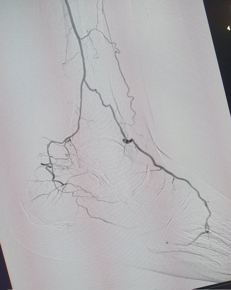 Interventional Radiology RPH tweet media