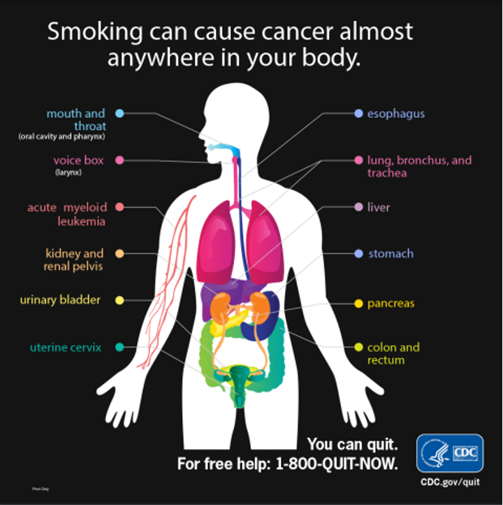 InsightWashCoTN's tweet photo. Secondhand smoke causes approximately 7,330 deaths from lung cancer and 33,950 deaths from heart disease each year. The best way to eliminate this exposure is to quit. Begin your quitting journey by calling 1-800-QUIT-NOW or text "Quit" to 615-795-0600.
#TNQuitWeek #TNSTOPTOBACCO https://t.co/6LUhaLCSFs