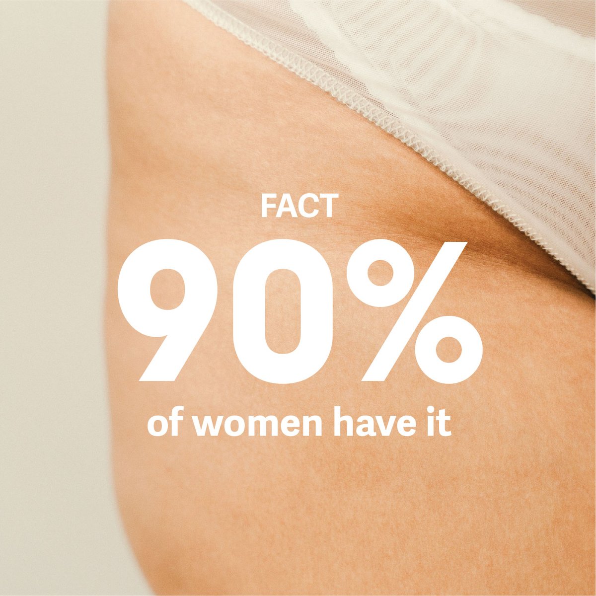 EmbryAesthetics's tweet photo. Butt first, let’s talk about cellulite.
To help prevent or decrease the appearance of cellulite, let’s tackle the problem underneath the skin! Qwo is the first and only FDA-approved injectable for moderate to severe cellulite in the buttocks of adult women. #embryaesthetics https://t.co/3MdjRBUTRZ