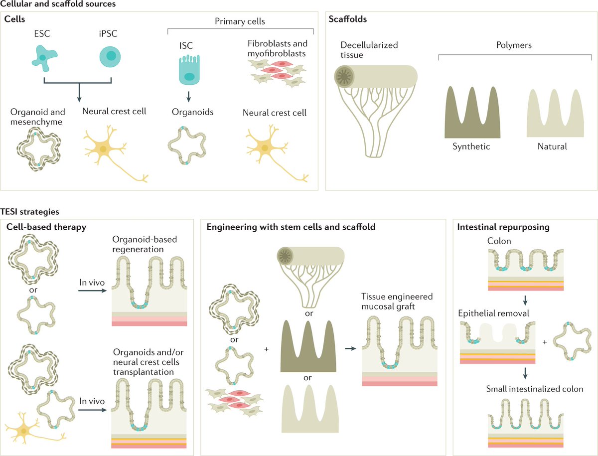 Nature Reviews Gastroenterology & Hepatology (@natrevgastrohep) on Twitter photo NEW! This Review on progress in intestinal tissue engineering by <a href="/lucindatullie/">Lucinda Tullie</a>, <a href="/DrBrendanJones/">Brendan Jones</a>, <a href="/paolodecoppi/">Paolo De Coppi</a> & <a href="/VivianLiLab/">Vivian Li</a>
go.nature.com/3HyCl2B NEW! This Review on progress in intestinal tissue engineering by <a href="/lucindatullie/">Lucinda Tullie</a>, <a href="/DrBrendanJones/">Brendan Jones</a>, <a href="/paolodecoppi/">Paolo De Coppi</a> & <a href="/VivianLiLab/">Vivian Li</a>
go.nature.com/3HyCl2B