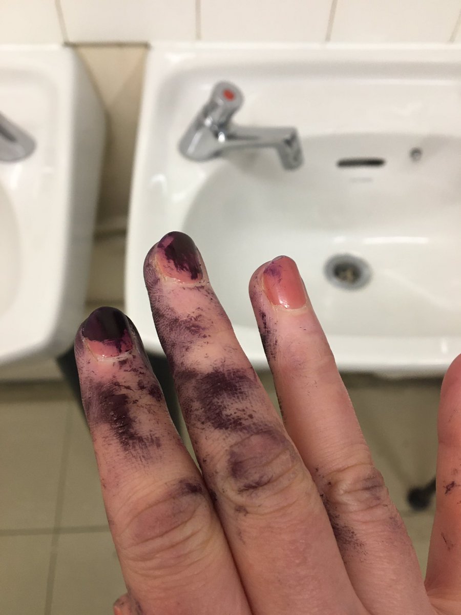 For all the non-believers, it happened to me! 😱😱😱
(And no, I wasn’t just trying to get out of a lesson! 😆)