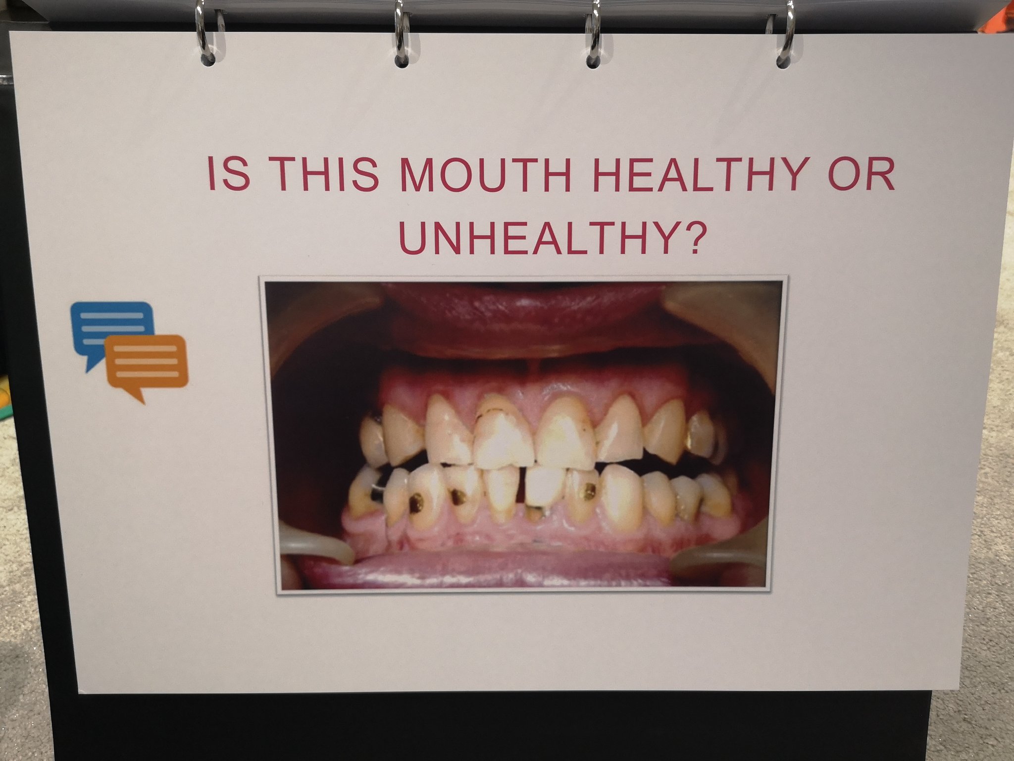 Knowledge Oral Health Care on Twitter "What do we think? Healthy or