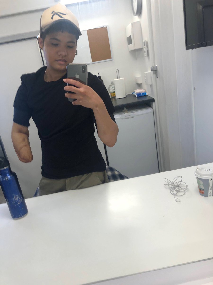 LexMayson's tweet image. I play Saff in Joe vs Carole that just came out on @peacockTV ! Here’s a pic of me with my prosthetic with bonus Kate McKinnon selfie