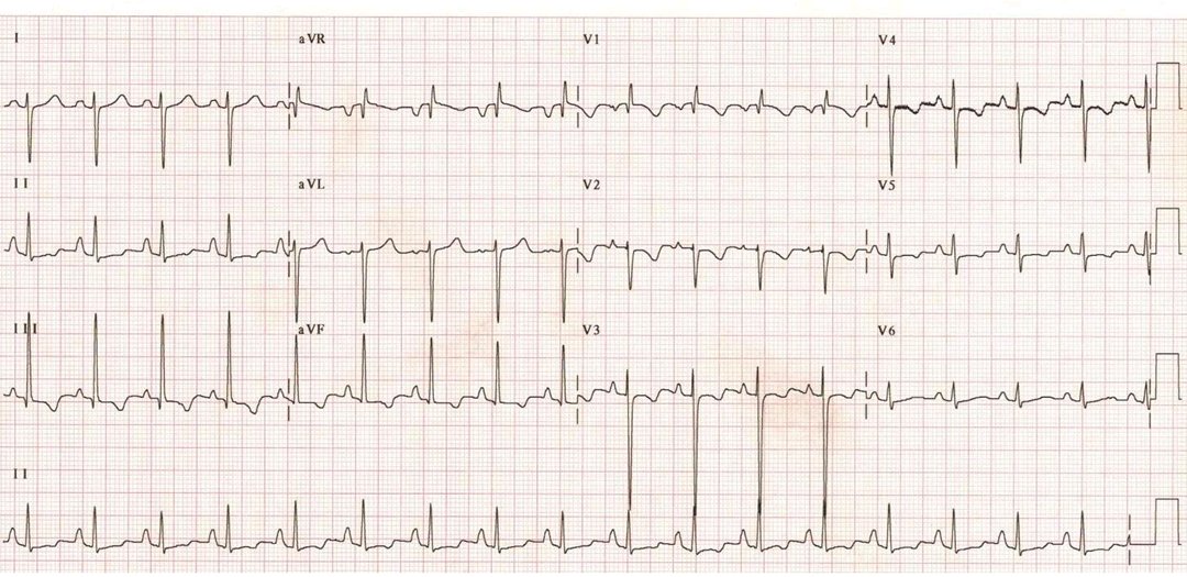 Dr Carlos Gutiérrez Torpey tweet media
