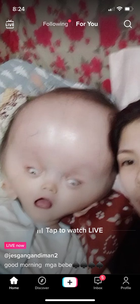 _Zummerz's tweet image. 