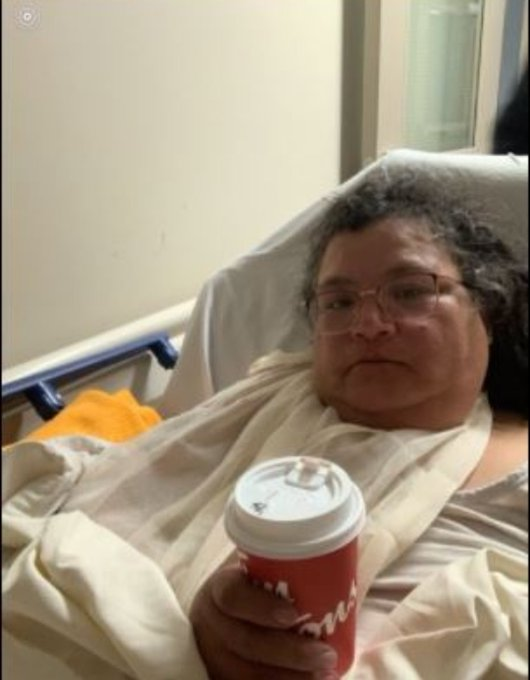 TheRealKeean's tweet photo. The woman who was trampled by Trudeau's officers is not dead. Thank god. Her shoulder was dislocated and she is in hospital. Care to correct the "no injuries" statement, @OttawaPolice? https://t.co/q3Pt2JcVfL
