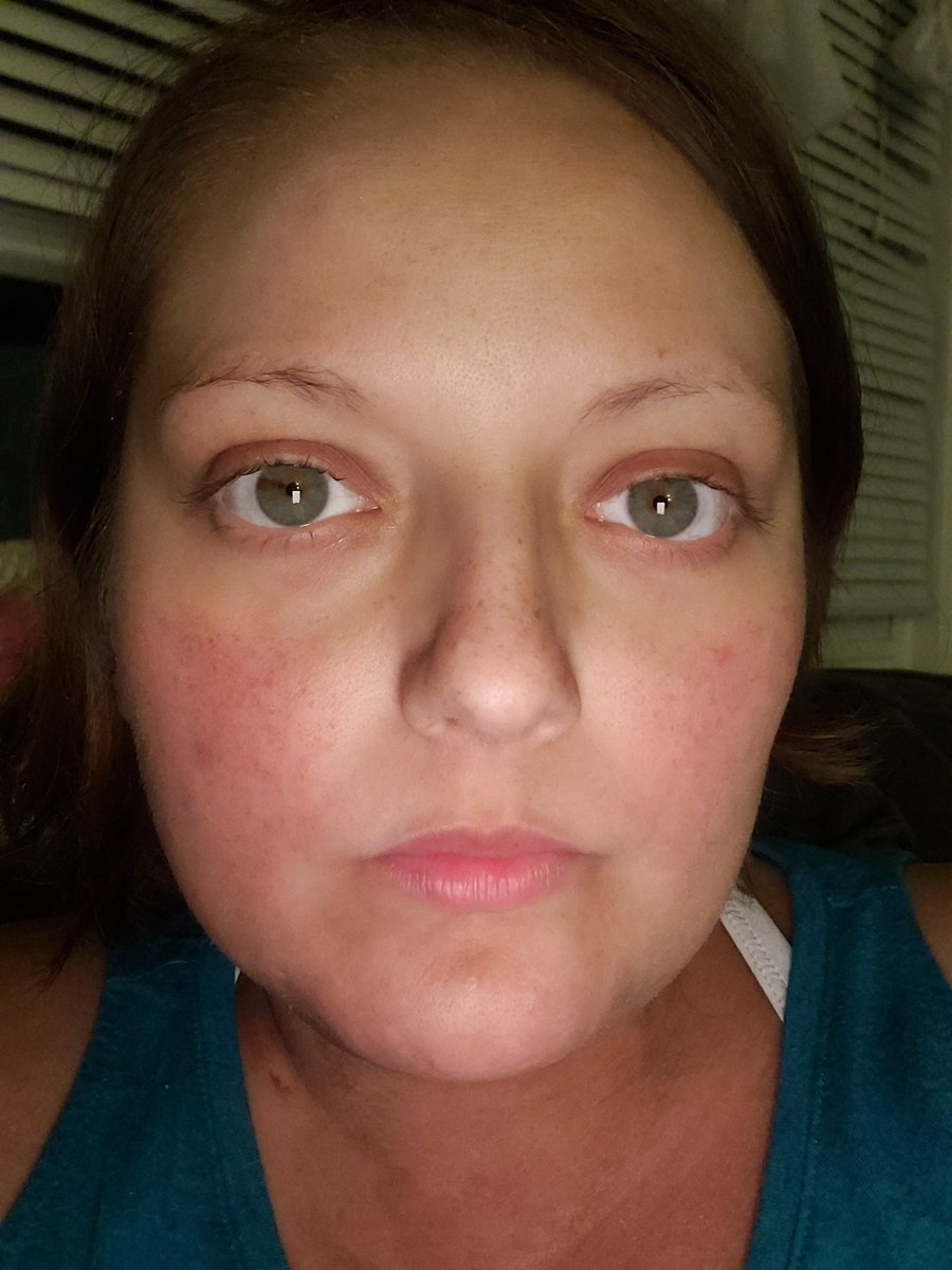 #BreastCancer hair regrowth progression pic! 

Today's hair (02/19/22) vs. 12/19/21, 10/19/21, and 08/19/21 

(Pics in order) 

#bcsm #cancer #hair #AYAcancer #cancerunder30