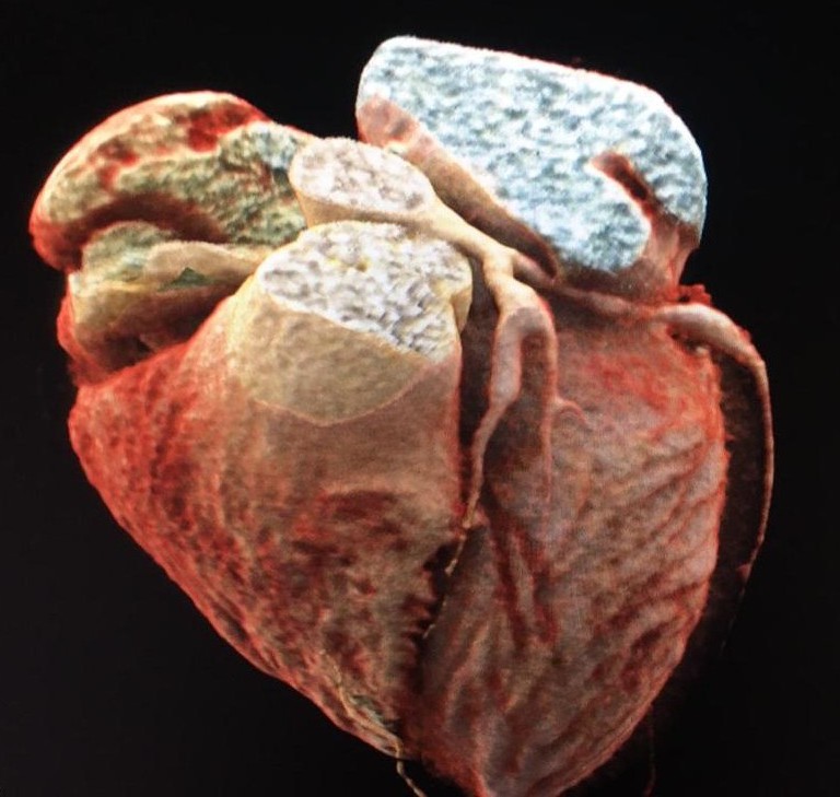 Dr Carlos Gutiérrez Torpey tweet media