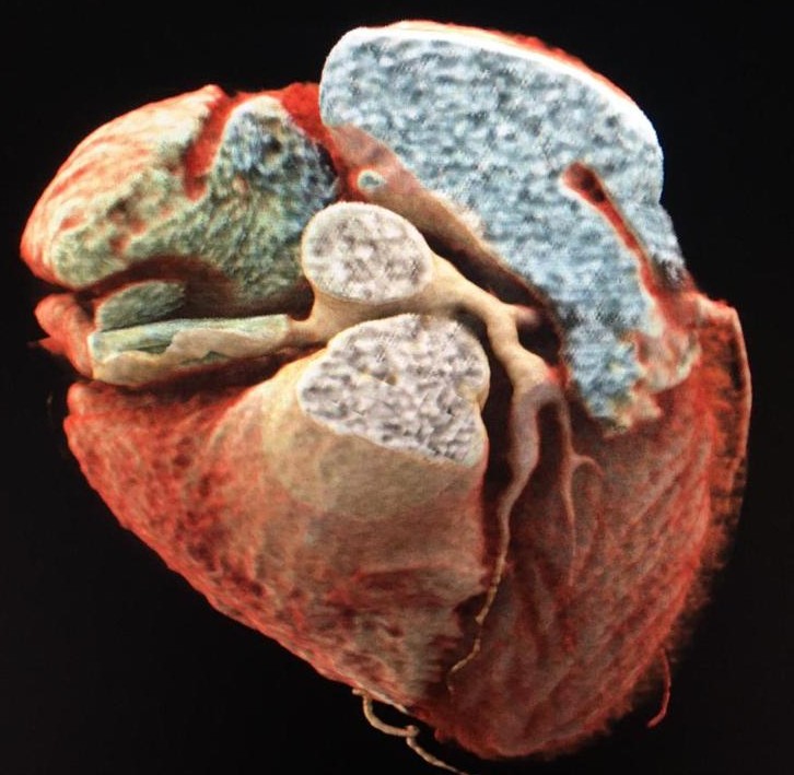 Dr Carlos Gutiérrez Torpey tweet media