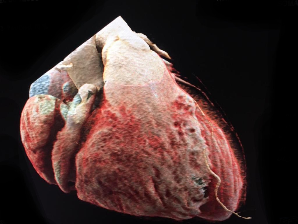 Dr Carlos Gutiérrez Torpey tweet media