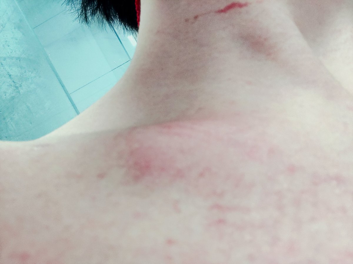 dm_suby's tweet image. 过了一天似乎还是浑身鞋印，红红的👟还有大块大块乌青😣

#男m #女s #踩踏 #恋足 #踩射 #鞋底 #上海 #调教 #现实 #女王 #踢裆 #乘骑 #舔鞋 #狗奴