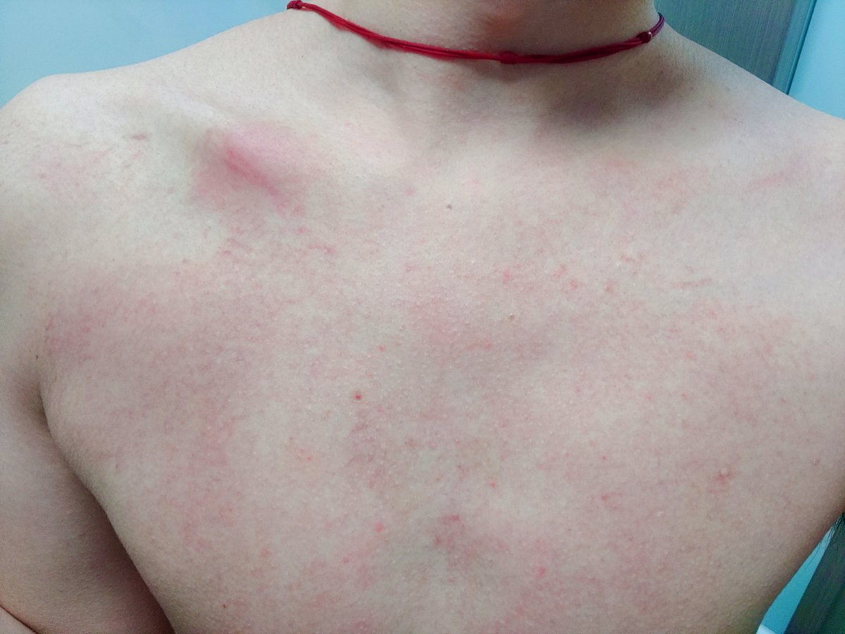 dm_suby's tweet image. 过了一天似乎还是浑身鞋印，红红的👟还有大块大块乌青😣

#男m #女s #踩踏 #恋足 #踩射 #鞋底 #上海 #调教 #现实 #女王 #踢裆 #乘骑 #舔鞋 #狗奴