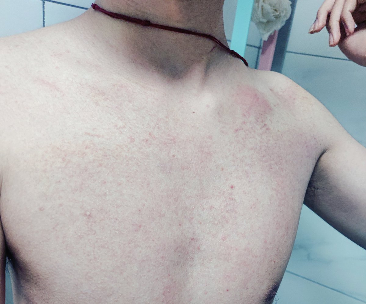 dm_suby's tweet image. 过了一天似乎还是浑身鞋印，红红的👟还有大块大块乌青😣

#男m #女s #踩踏 #恋足 #踩射 #鞋底 #上海 #调教 #现实 #女王 #踢裆 #乘骑 #舔鞋 #狗奴