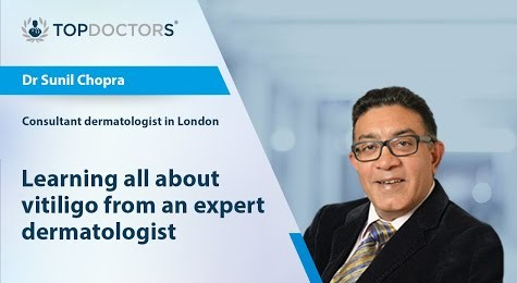 TopDoctors_UK's tweet photo. 🩺People may recognise the condition of #vitiligo, but how much do we really know about it? 

In this video, experienced consultant #dermatologist Dr Sunil Chopra tells us all about it.

Watch it here 👉 https://t.co/DwaMtwmtNK
#eHealth #eConsultation https://t.co/Pa1ntMTngk