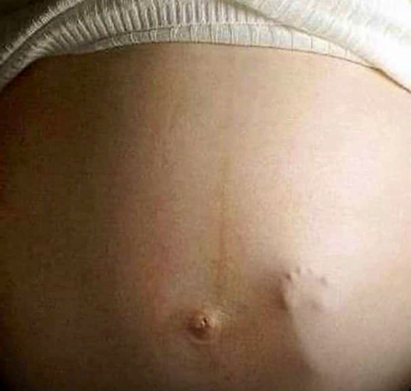 Women , does this thing really happen or is this a photoshop 😲 ?