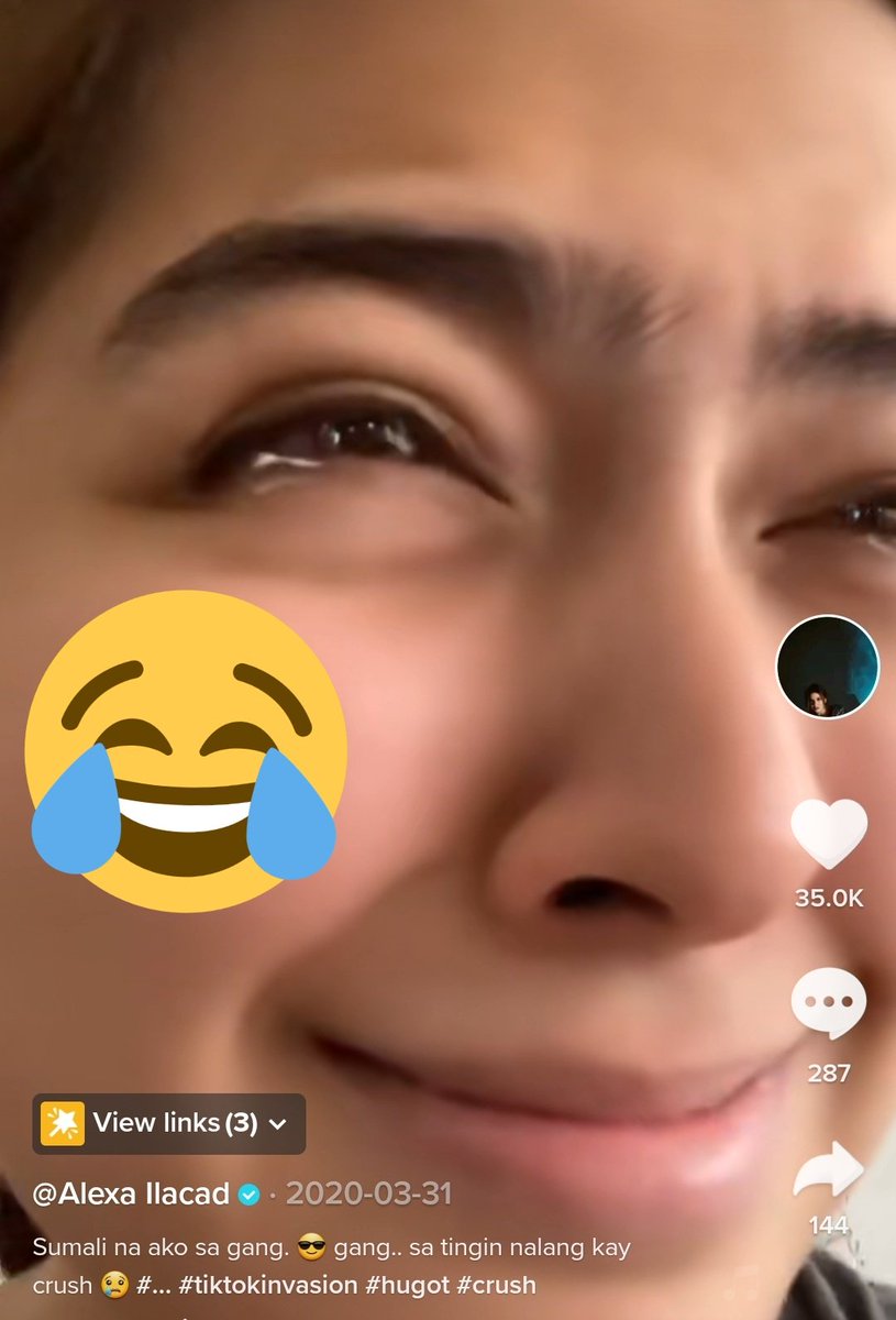 bonie_bear's tweet photo. Why soooo cute hahaha

ALEXAmazing BdayOnASAP https://t.co/HkKMmhkkDp
