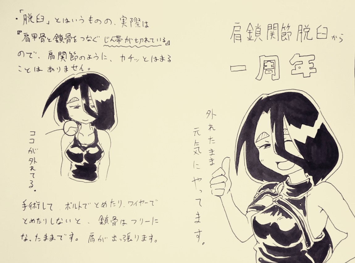 鎖骨脱臼から一年経ちました。
#受肉ちゃん 