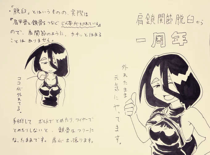 鎖骨脱臼から一年経ちました。
#受肉ちゃん 