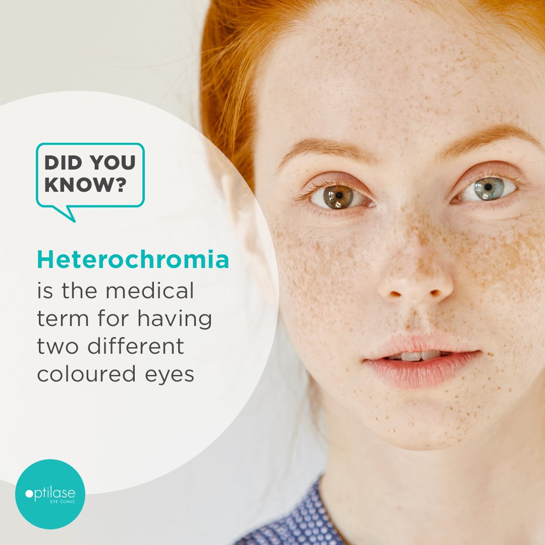 optilaseireland's tweet photo. Did you know that the medical term for having two different coloured eyes is "heterochromia." 

It's quite uncommon, occurring in less than 1% of the population💚

Do you know anyone with two different coloured eyes?

#eyes #optilase #seethedifference https://t.co/2uzYZOB0JF
