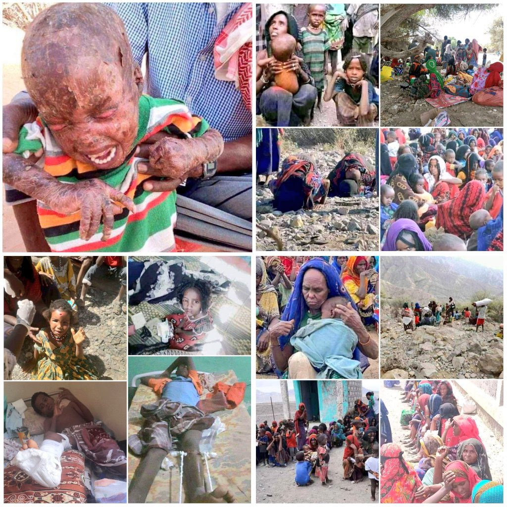 son1_afar's tweet photo. #Afar people #sacrifices their life to protect Ethiopia from #TPLF.  Childrens in #Northern_Afar, not only they are  out of school for 15months  but also raped by gangs of #TPLFTerroristGroup
They are in starvation &amp; lack of medicine. 
#AfarUnderAttack
#save_Afar
#AfarCantWait https://t.co/6BjZlORZ55