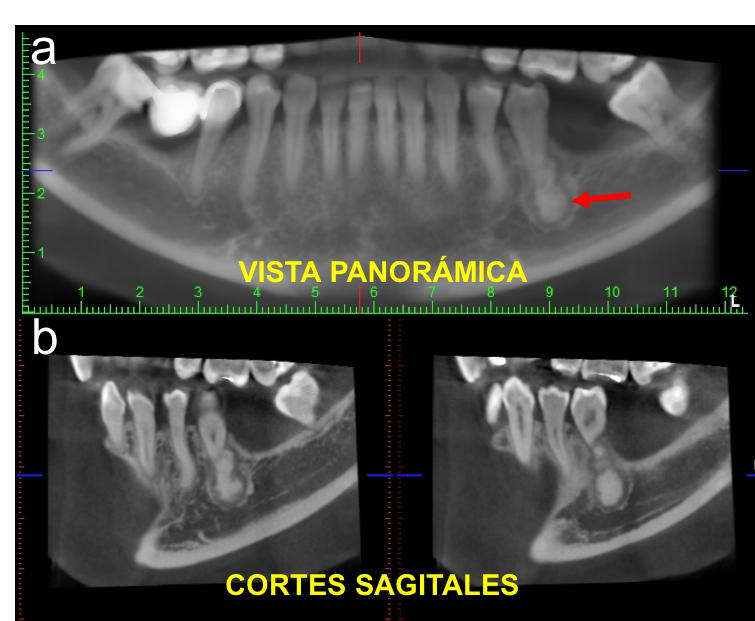 CIDEMImagen's tweet photo. Es importante para nosotros recibir la indicación del examen radiográfico. Una breve reseña del motivo de consulta del paciente facilita la selección del examen y el reporte radiográfico del caso. 
#Cidem #Radiology https://t.co/1tkaD8Z6E0
