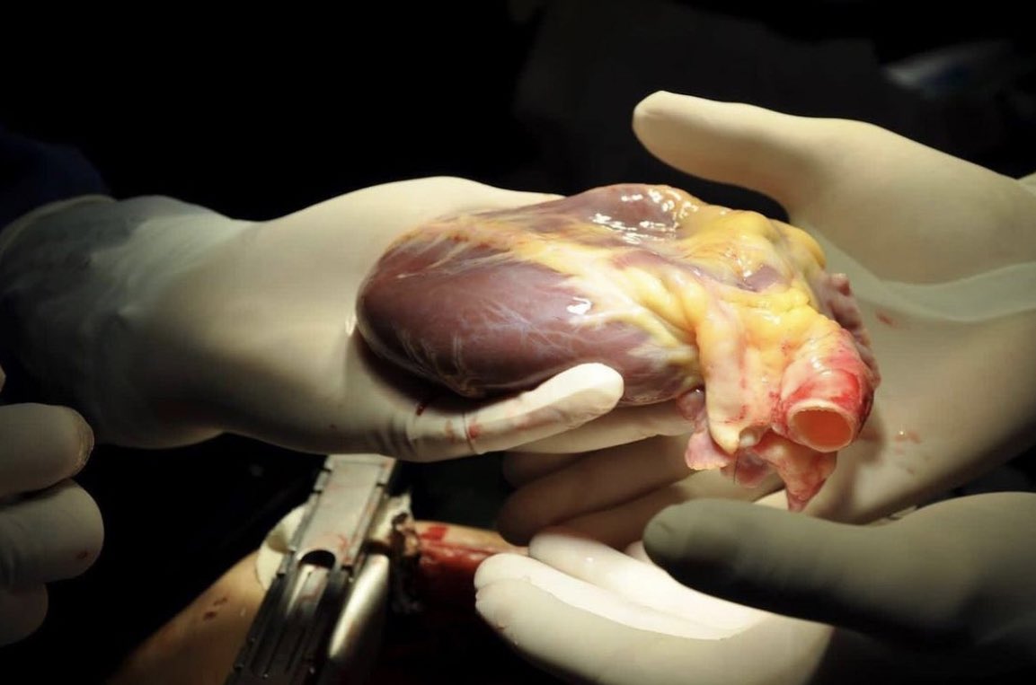 ‘O an!’

Nakil sırasında cerraha uzatılan ve sahibine ikinci bahara yaşatacak olan sağlıklı kalp.