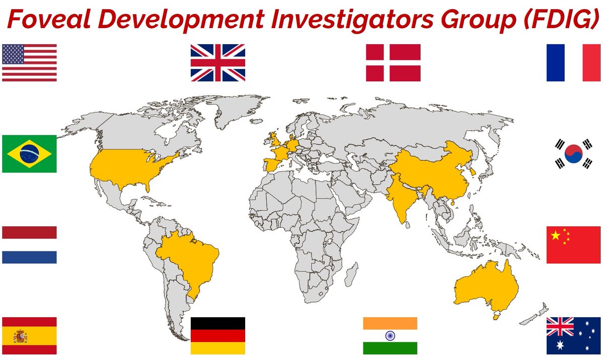 Delighted to share our latest📖on arrested foveal development and our expanding🌍initiative (12+countries/centres). Email/msg if area of expertise/interested to join. Honoured to lead this. Lots of hard work from each centre and especially <a href="/KuhtHelen/">Helen Bauckham (Kuht)</a>. tinyurl.com/2p9an2d3 1/5