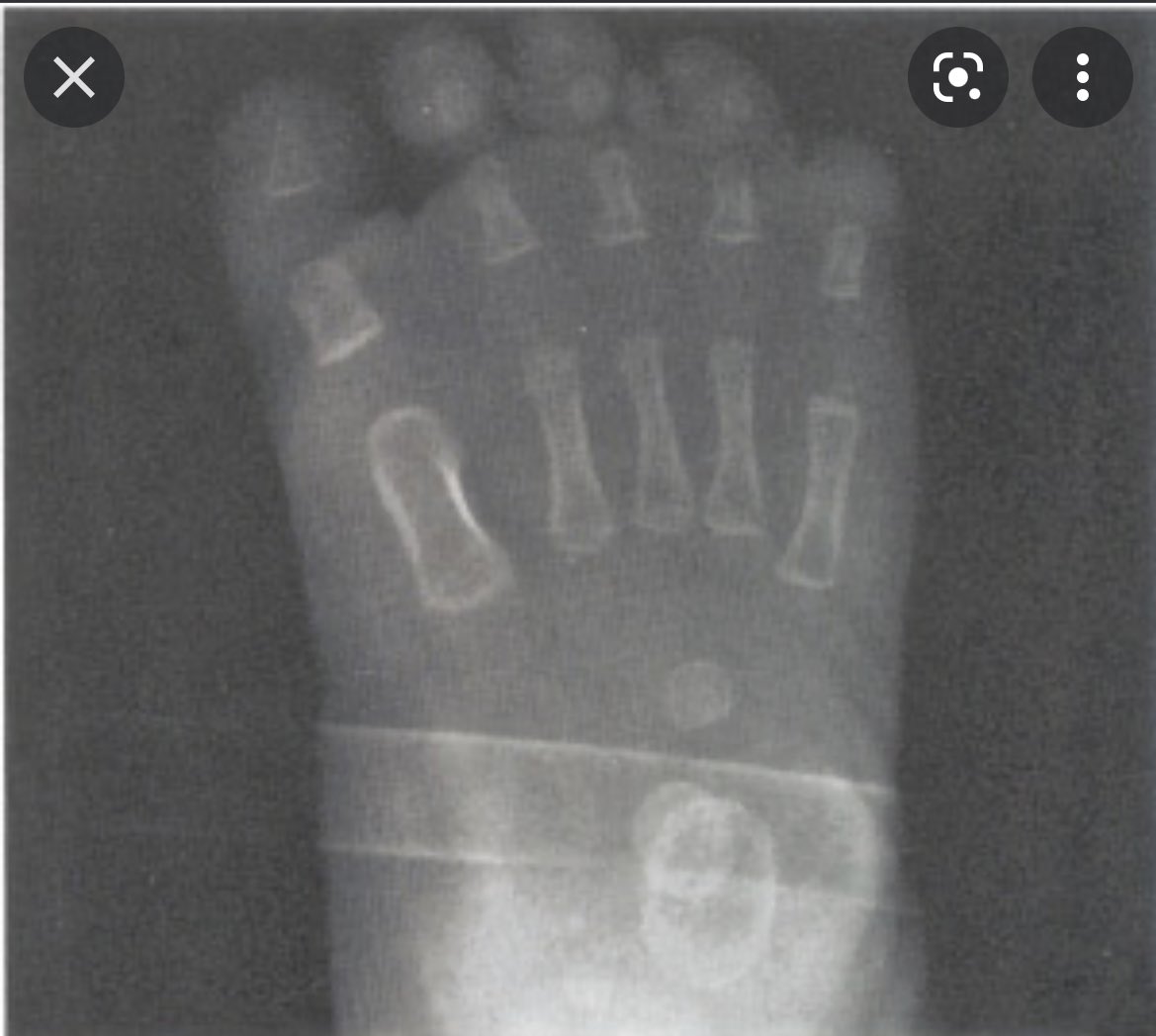 Taylor_Winkel's tweet photo. @Scooptwotimes look at their little toes too😭 and the second pic is an example of femur growth!! https://t.co/WzRCJbPnuK