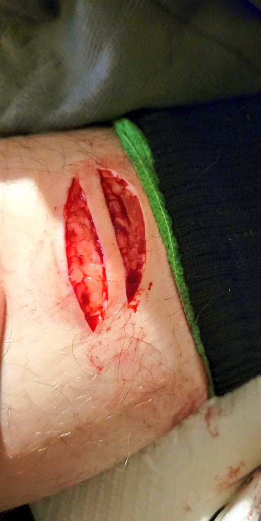 eclipse19085409's tweet photo. this is amazing, ruined my 24 day streak tho shtwt beanstwt shbeans goretwt cutspo https://t.co/Dg5AJ66CO3