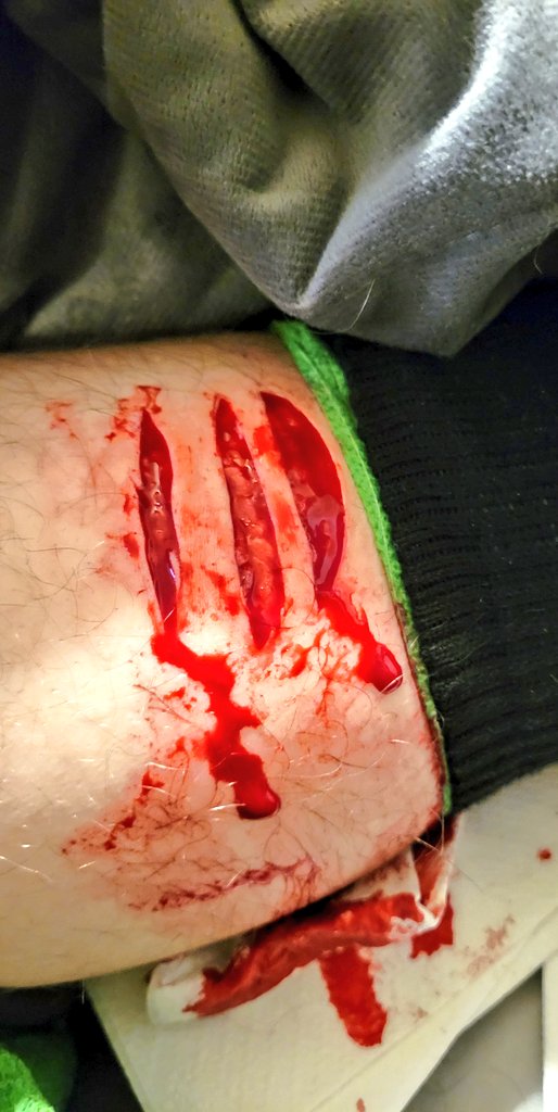 eclipse19085409's tweet photo. this is amazing, ruined my 24 day streak tho shtwt beanstwt shbeans goretwt cutspo https://t.co/Dg5AJ66CO3