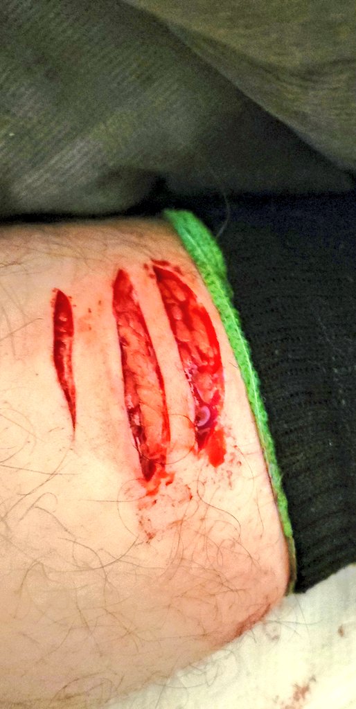 eclipse19085409's tweet photo. this is amazing, ruined my 24 day streak tho shtwt beanstwt shbeans goretwt cutspo https://t.co/Dg5AJ66CO3