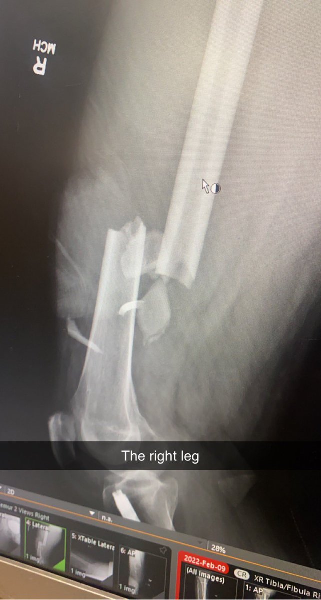 bradyharris11's tweet photo. The ER is a wild place. 🦴 https://t.co/ZaJhWuxovV