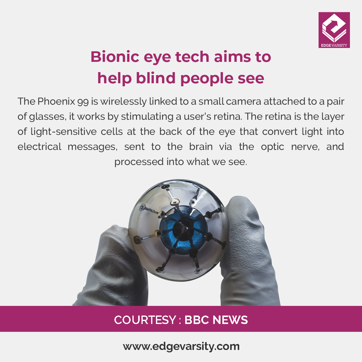 edge_varsity's tweet photo. Tech Update!
Source: https://t.co/oa6DmN68XV

 #BBC #news #eye #helpblind #BionicEye #technews #techupdates #triggers #bionic #blind #bbcnews https://t.co/sVeKqCR0vZ