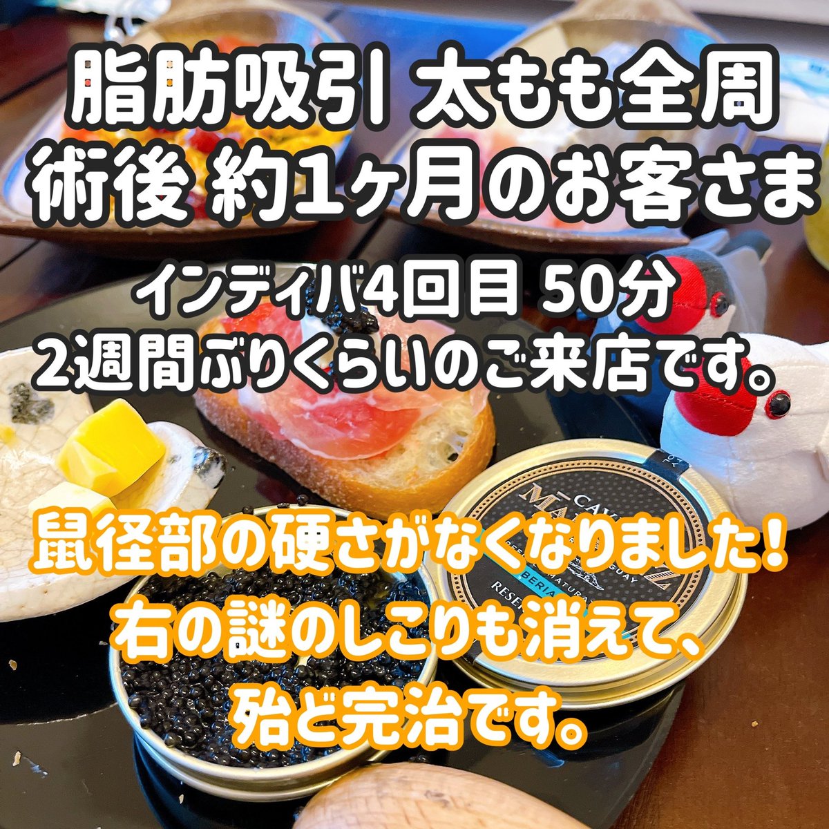 rainbowst78's tweet photo. #青山 #表参道 #外苑前
インディバサロン RainbowFactory78

#脂肪吸引 #拘縮ケア #脂肪吸引後ケア #インディバ #脂肪吸引後にインディバ #インディバサロン #ダウンタイム
#ジョールファット #バッカルファット #脂肪注入 #豊胸 https://t.co/j7anDUTYiN