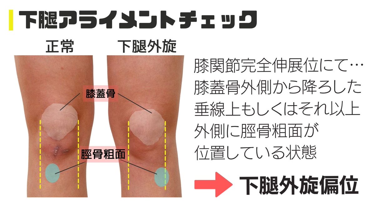 Hiroki Ejiri｜エジリヒロキ/整形PT on X: 