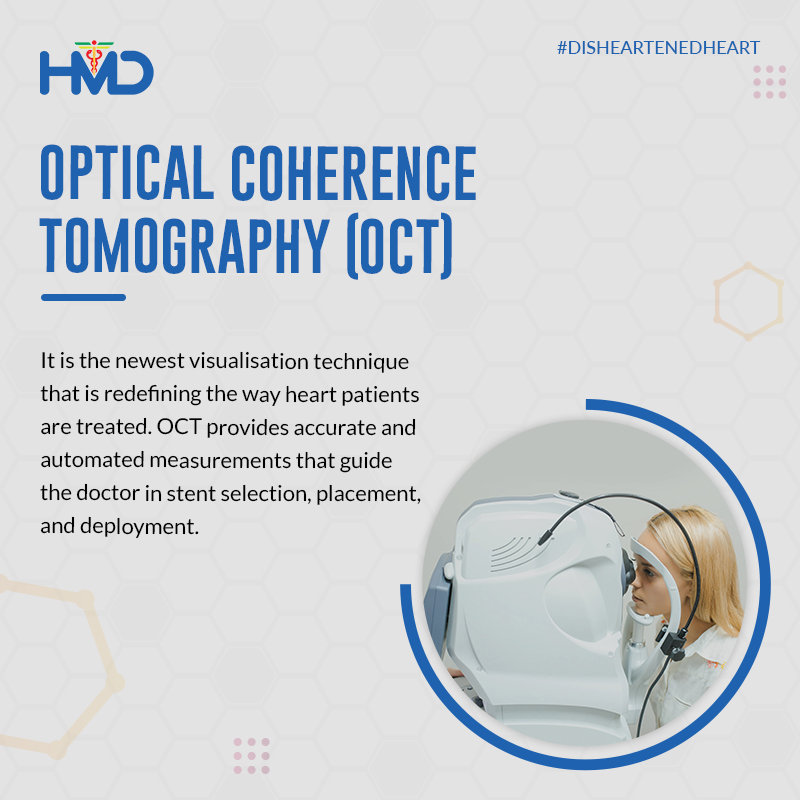 hmdhealthcare's tweet photo. OCT uses near-infrared light to produce high-resolution images of the #bloodvessels. It allows #cardiologists to see the plaque inside an artery in more detail & take precise measurements before & after stent placement
#DisheartenedHeart #HeartTech #HeartDisease #HeartTreatment https://t.co/SyqVrZNNbd