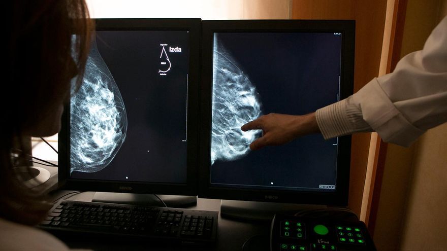 elperiodico's tweet photo. ‼Un fármaco creado en Vall d'Hebron frena la metástasis del cáncer de mama https://t.co/nD6D3I2vDd https://t.co/Nr7be8teWD