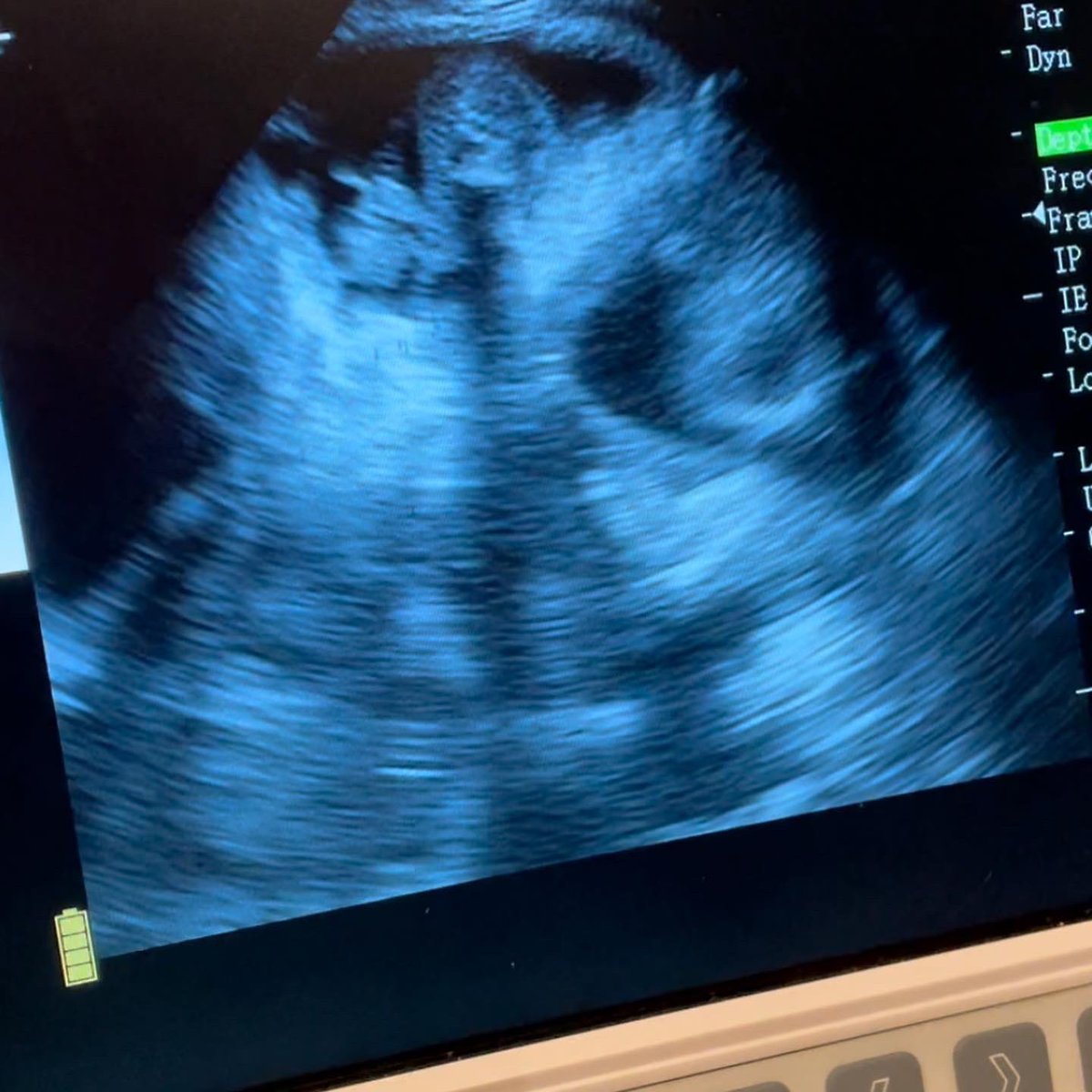 beckyjadesurman's tweet image. Now doing #ultrasoundscanning #petultrasoundscanning to confirm pregnancy, to give an estimated number of puppies and estimated delivery date #bedford #pregnancyscanning #petpregnancyscans #braveshotgundogs