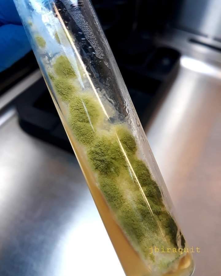 mICROBIOsh's tweet photo. Un hombre diabético de 57 años se presentó con tos y dificultad para respirar después de una historia de 5 días de fiebre y dolor de espalda. https://t.co/jcaSMBL4mh