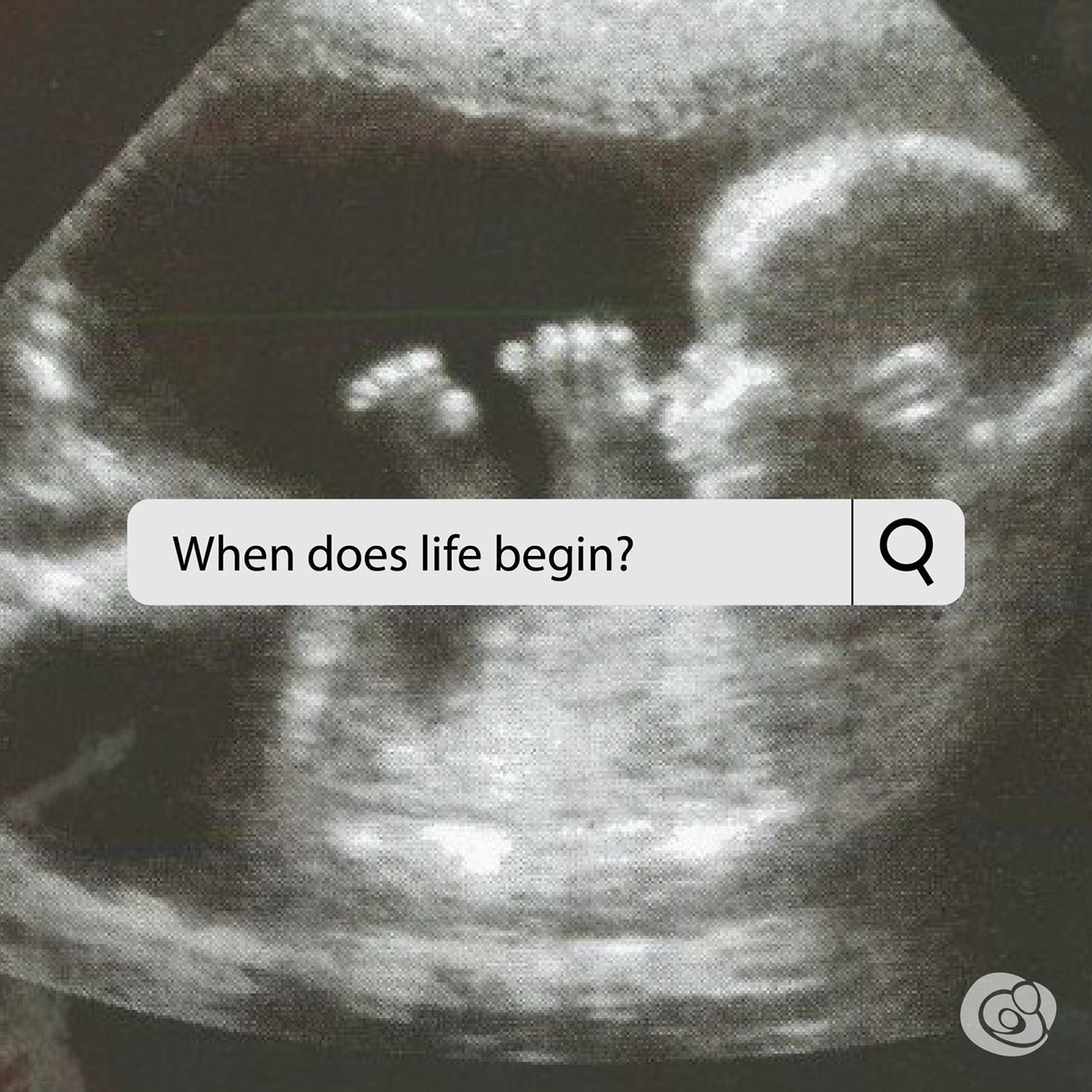 March_for_Life's tweet photo. The science is clear when life begins.

“In that fraction of a second when the chromosomes form pairs...hereditary characteristics received from each parent will be set, and a new life will have begun.” (Human Development: The Span of Life) https://t.co/m3VZieDz9z